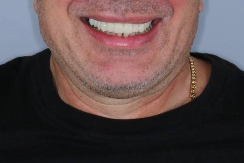 11-1