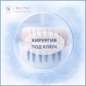 Наращивание костной ткани
